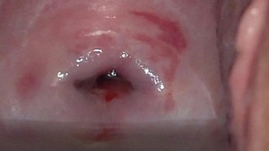 cervix