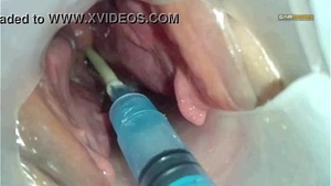 Semen injected into another mans uterus