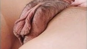 Pussy stoma and breast collecting