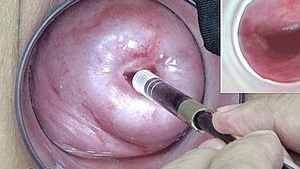 Japanese CAM cervical dominant camera endoscope earn vagina