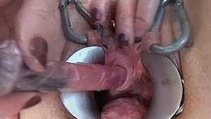 Extreme behavior - Violence in video fisting related to dildo counseling