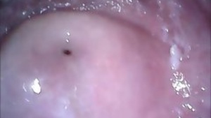 This amateur video shoots the anus and vagina close up.